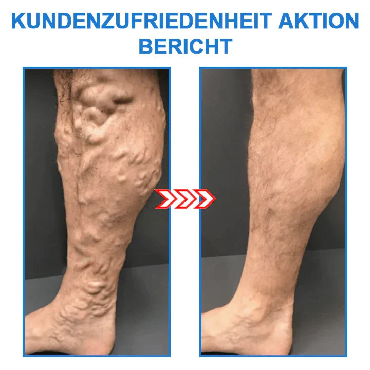 Pylomo™ Tourmaline Ionic Body Shaping Stretch-Socken | 1+2 Gratis!